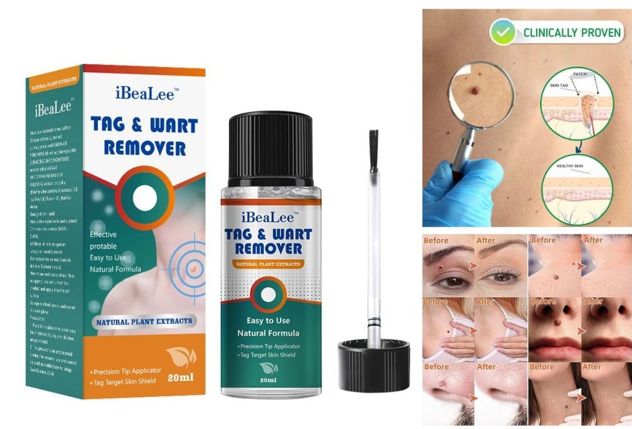 Skin Tag Remover (20ml)